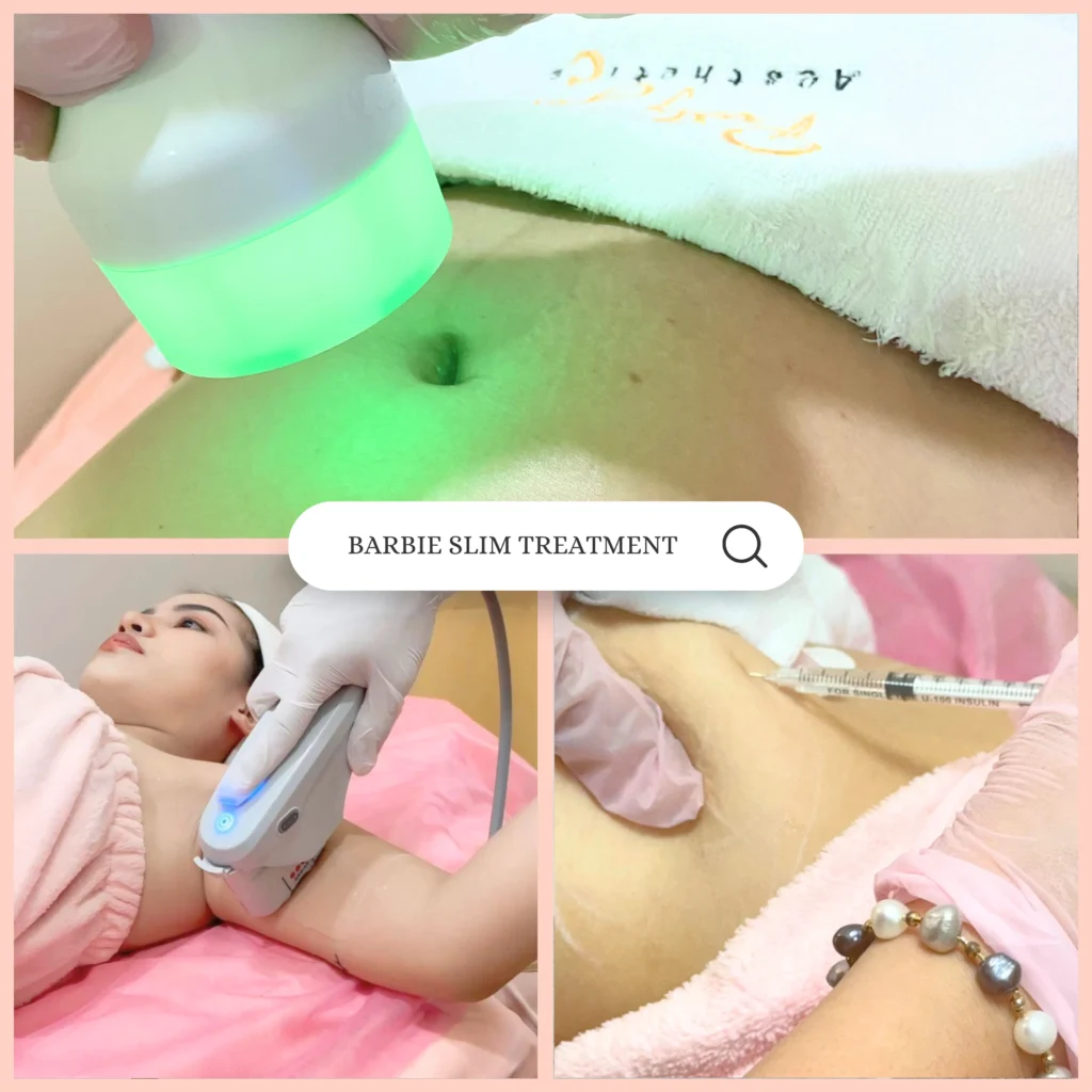 barbie slim treatment